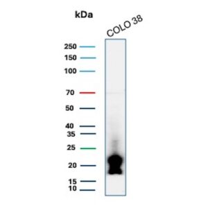 MART-1 Antibody in Western Blot (WB)