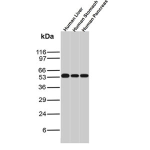 ALDH1A1 Antibody in Western Blot (WB)