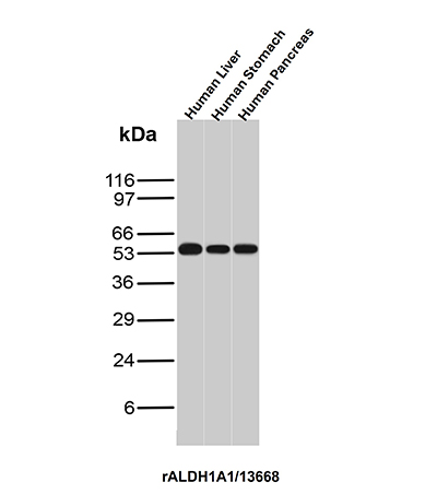 Western Blot Analysis of Liver, Stomach and Pancreas of human tissue lysates using ALDH1A1 Recombinant Mouse Monoclonal Antibody (rALDH1A1/13668). ALDH1A1 Antibody in Western Blot (WB)