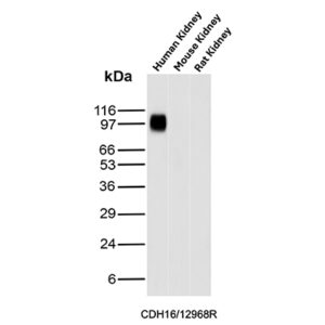 Ksp-Cadherin Antibody in Western Blot (WB)