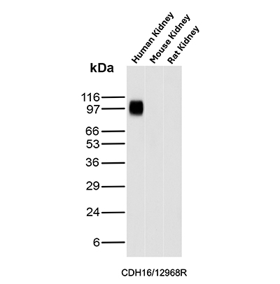 Western Blot Analysis of Human Kidney, Mouse Kidney and Rat Kidney tissue lysates using Ksp-Cadherin Recombinant Rabbit Monoclonal Antibody (CDH16/12968R). Ksp-Cadherin Antibody in Western Blot (WB)
