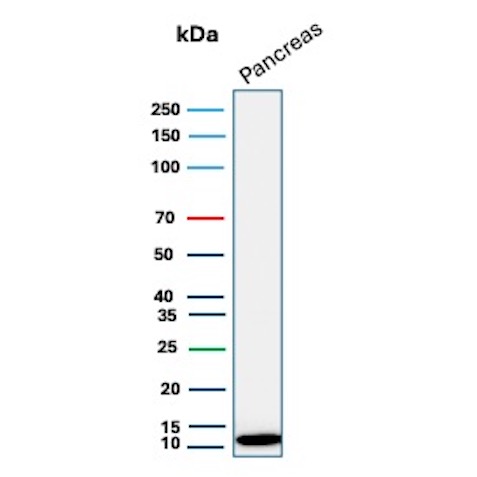 Western blot analysis of Human pancreas tissue lysate using Colipase Rabbit Recombinant Monoclonal Antibody (CLPS/12972R). Colipase Antibody in Western Blot (WB)