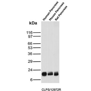 Colipase Antibody in Western Blot (WB)