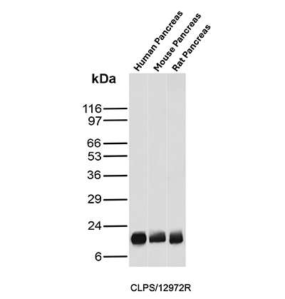Western blot analysis of Human pancreas, Mouse pancreas and Rat pancreas tissue lysates using Colipase Rabbit Recombinant Monoclonal Antibody (CLPS/12972R). Colipase Antibody in Western Blot (WB)