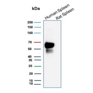 CD16 / FCGR3A Antibody in Western Blot (WB)