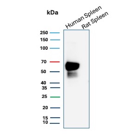 Western Blot Analysis of Human Spleen and Rat Spleen tissue lysates using CD16 / FCGR3A Recombinant Rabbit Monoclonal Antibody (FCGR3A/12961R). CD16 / FCGR3A Antibody in Western Blot (WB)