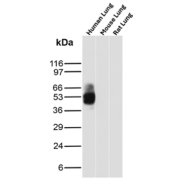 Western Blot Analysis of Human Lung, Mouse Lung and Rat Lung tissue lysates using CD16 / FCGR3A Recombinant Rabbit Monoclonal Antibody (FCGR3A/12961R). CD16 / FCGR3A Antibody in Western Blot (WB)