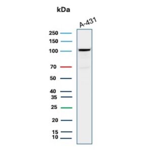 MCM6 Antibody in Western Blot (WB)