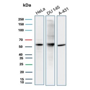 PTEN Antibody in Western Blot (WB)