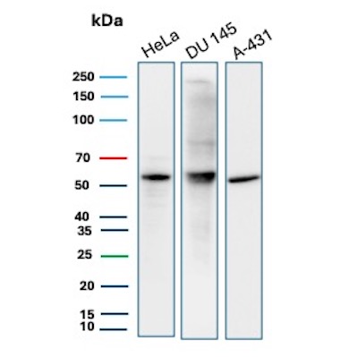 Western Blot Analysis of HeLa, DU 145 and A-431 cell lysates using PTEN Rabbit Recombinant Monoclonal Antibody (PTEN/12943R). PTEN Antibody in Western Blot (WB)
