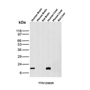 Transthyretin Antibody in Western Blot (WB)