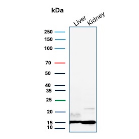 Western blot analysis of human liver and kidney tissue lysates using Transthyretin Recombinant Rabbit Monoclonal Antibody (TTR/12960R). Transthyretin Antibody in Western Blot (WB)