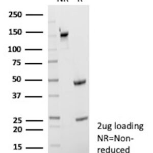 CD40 Antibody in SDS-PAGE