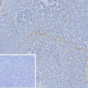 E-Selectin Antibody in Immunohistochemistry (IHC (P))