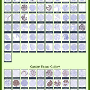 CDH17 Antibody in Numerous Tissues (IHC)