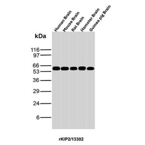 p57 Antibody in Western Blot (WB)