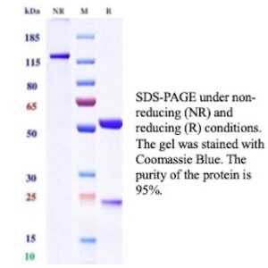 Uroplakin 1A / UPK1A Antibody in SDS-PAGE