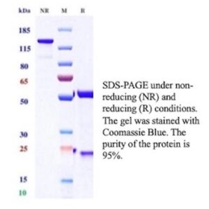 MCM3 / MCM-3 Antibody in SDS-PAGE