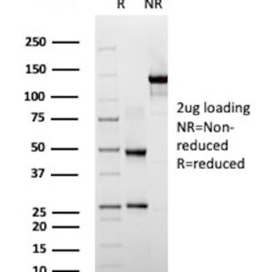 CD45RO Antibody in SDS-PAGE