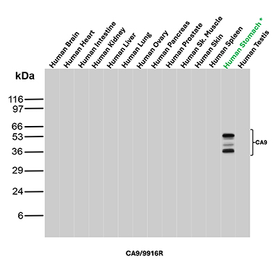 Western Blot Analysis of Human Brain, Human Heart, Human Intestine, Human Kidney, Human Liver, Human Lung, Human Ovary, Human Pancreas, Human Prostrate, Human Skeletal Muscle, Human Skin, Human Spleen, Human Stomach and Human Testis tissue lysates using Carbonic Anhydrase IX Recombinant Rabbit Monoclonal Antibody (CA9/9916R). Carbonic Anhydrase IX Antibody in Western Blot (WB)