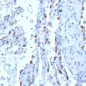 Surfactant Precursor Protein B Antibody in Immunohistochemistry (IHC (P))