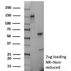IGF1R Antibody in SDS-PAGE