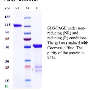 Interferon gamma / IFNG Antibody in SDS-PAGE