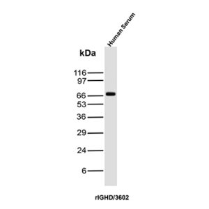 IgD Antibody in Western Blot (WB)