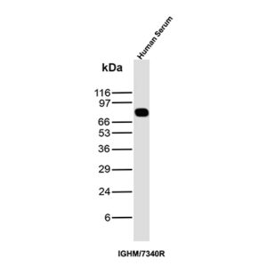 IgM Antibody in Western Blot (WB)