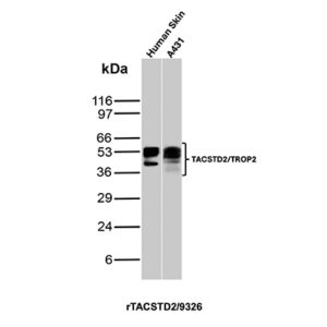 TACSTD2 / TROP2 (Epithelial Marker) Antibody in Western Blot (WB)