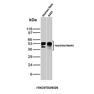 Western blot analysis of Human skin and A-431 lysates using TACSTD2 / TROP2 (Epithelial Marker) Recombinant Mouse Monoclonal Antibody (rTACSTD2/9326). TACSTD2 / TROP2 (Epithelial Marker) Antibody in Western Blot (WB)