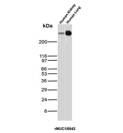 Western Blot Analysis of Human kidney and Human Lung tissue lysates using MUC1 Recombinant Mouse Monoclonal Antibody (rMUC1/6942). MUC1 Antibody in Western Blot (WB)