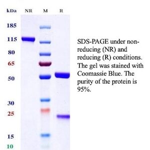 TrkB / NTRK2 (Neurotrophic Receptor Tyrosine Kinase 2) Antibody in SDS-PAGE