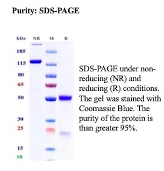 SDS-PAGE Analysis of Purified SOX10 Recombinant Mouse Monoclonal Antibody (rSOX10/13642). Confirmation of Purity and Integrity of Antibody. SOX10 Antibody in SDS-PAGE