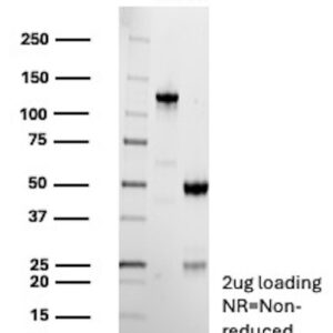 TRPS1 Antibody in SDS-PAGE