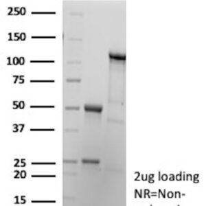 VIM Antibody in SDS-PAGE