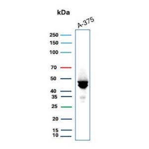 MAGEA4 Antibody in Western Blot (WB)