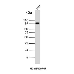 MCM6 Antibody in Western Blot (WB)
