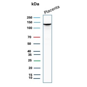 E-Cadherin Antibody in Western Blot (WB)