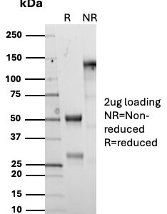 IGF1 Antibody in SDS-PAGE