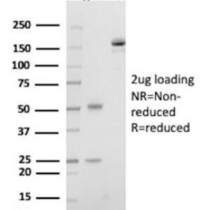 SHBG Antibody in SDS-PAGE