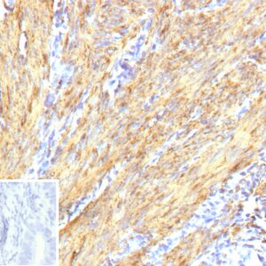 Smooth Muscle Actin Antibody in Immunohistochemistry (IHC (P))