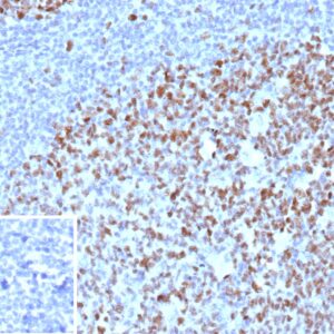 Formalin-fixed, paraffin-embedded human tonsil stained with MCM5 Mouse Monoclonal Antibody (MCM5/3200). Inset: PBS instead of primary antibody; secondary only negative control. MCM5 Antibody in Immunohistochemistry (IHC (P))