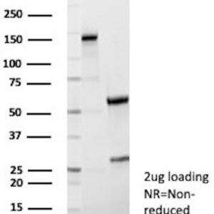 Human Nuclear Antigen Antibody in SDS-PAGE