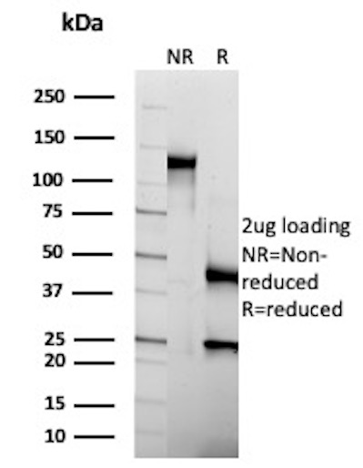 SDS-PAGE Analysis of Purified Cadherin-16 Recombinant Mouse Monoclonal Antibody (rCDH16/1071). Confirmation of Purity and Integrity of Antibody. CDH16 Antibody in SDS-PAGE