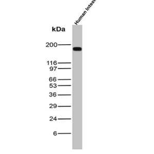 CEA Antibody in Western Blot (WB)