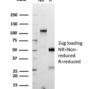 IGHA1 Antibody in SDS-PAGE