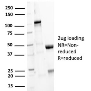 MMP3 Antibody in SDS-PAGE