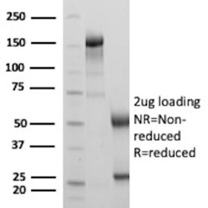 Melanoma Associated Antigen Antibody in SDS-PAGE