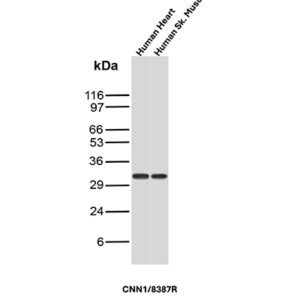 Calponin-1 Antibody in Western Blot (WB)